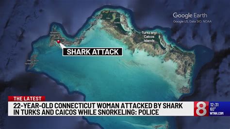 U.S. woman loses leg in shark attack snorkeling in Turks and Caicos